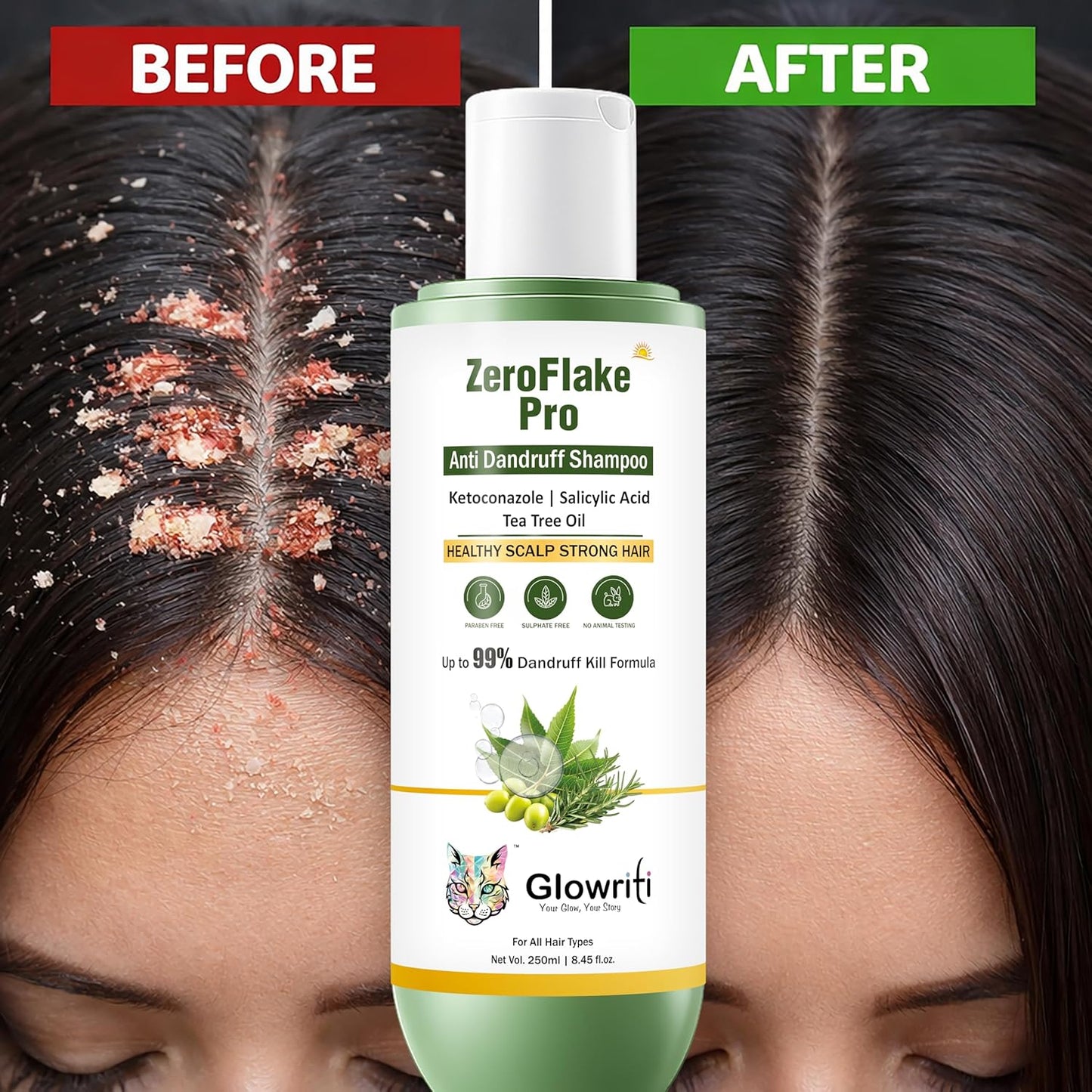 Anti-Dandruff Shampoo | Guaranteed Visible Results